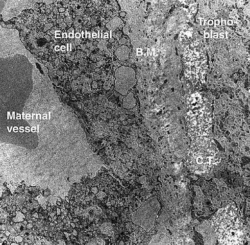 Electron micrograph of 'barrier' in C. didactylus BM=basement membrane, C.T.= connective tissue