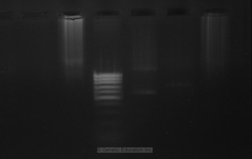 PCR gel electrophoresis result image  6.