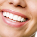 Top Differences Between Teeth Whitening & Teeth Bonding