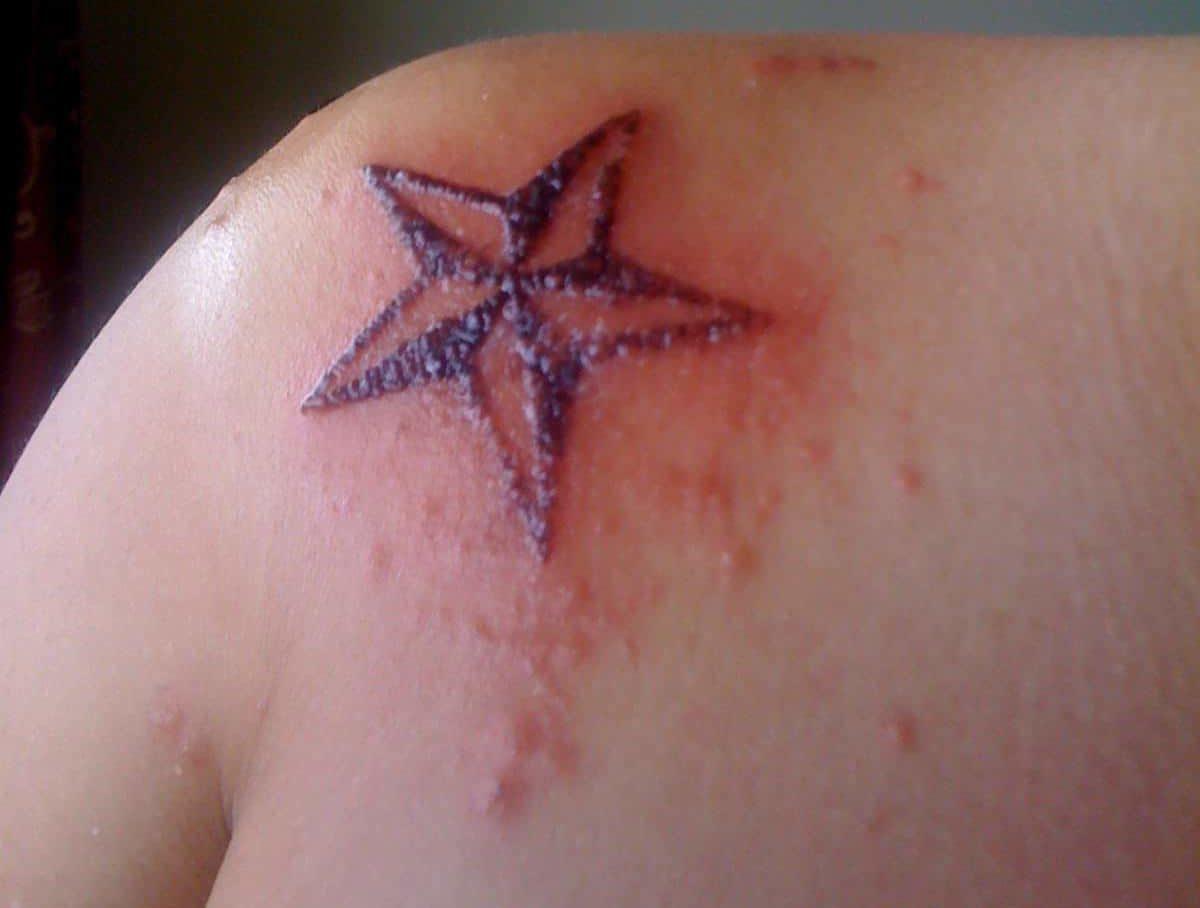 Infected Tattoo Stages: Signs of Infection from Tattoos and After Tattoo  Removal | Removery