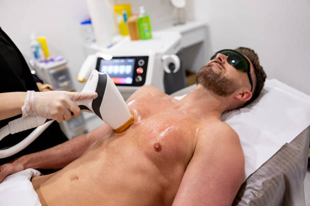 Ulike laser hair removal