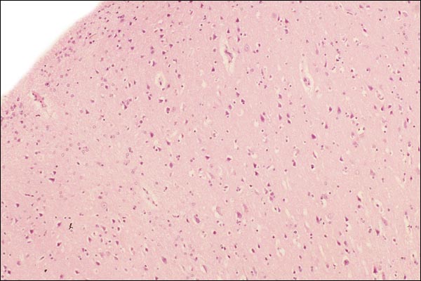 Sections of brain of Liontailed macac with uligyria