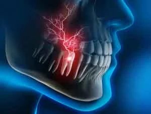 teeth-pain1