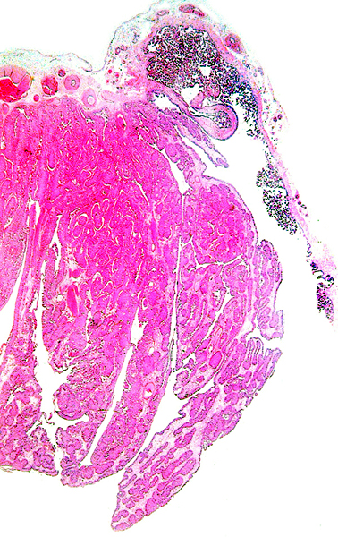'Papillary' projection on outer placental surface