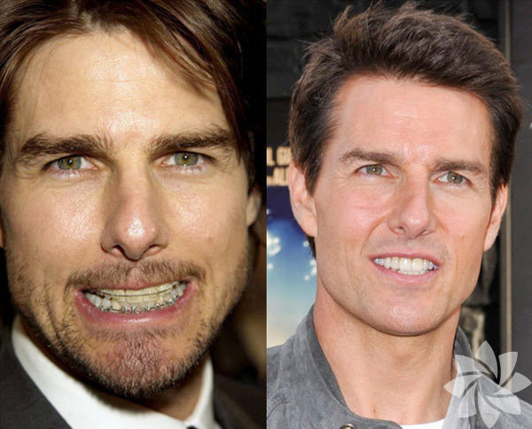 Tom Cruise