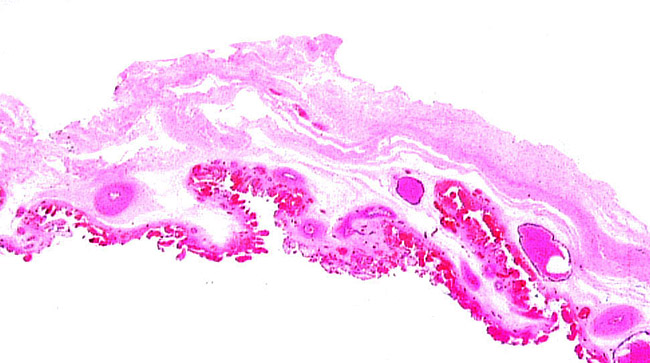 Surface of warthog placenta with very congested villi.