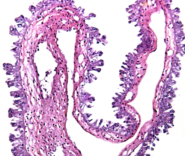 This is a small segment of the inverted yolk sac membranes with the yolk sac-derived epithelium at outside and being moderately macerated.