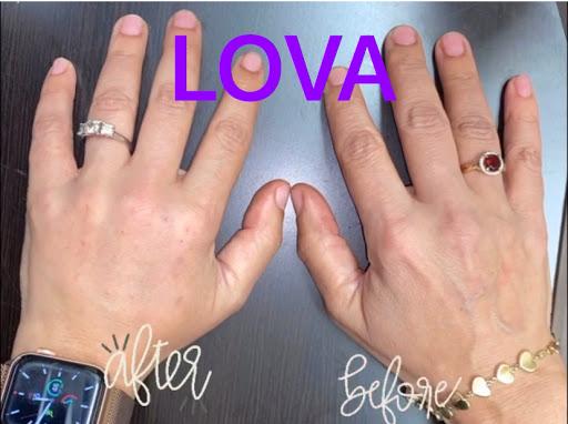 Explore dragonfly flower tattoo ideas, creative tattoo ideas in Lake Oswego, available at Lake Oswego Vein and Aesthetic LOVA