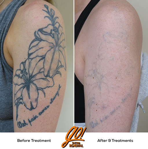 Find jewel tattoo ideas for your next unique tattoo in Allentown at Removery Tattoo Removal & Fading
