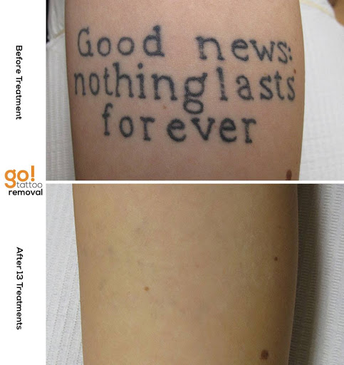 Explore small leg tattoo ideas, creative tattoo ideas in Allentown, available at Removery Tattoo Removal & Fading