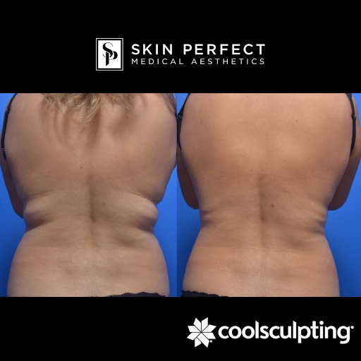 Explore silver lining tattoo ideas, creative tattoo ideas in Whittier, available at Skin Perfect Medical Aesthetics