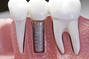 Deep Dental Implant Centre And Physiotherapy image