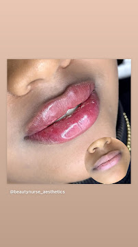 beauty nurse aesthetics - Photo 6 - Car repair in Hartsdale, NY, Yonkers