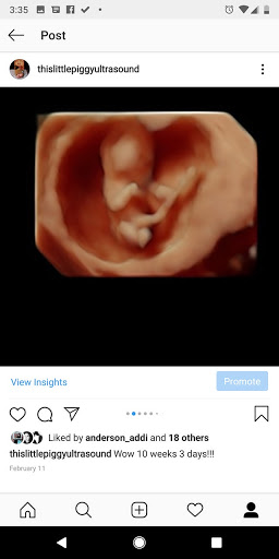 Medical Diagnostic Imaging Center «My little baby 4d & boutique», reviews and photos, 8930 TX-121, McKinney, TX 75070, USA