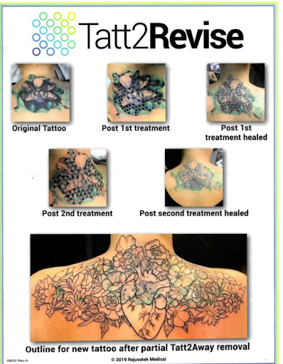 Explore bingo tattoo ideas, creative tattoo ideas in Fort Worth, available at Here 2Day Gone 2Morrow Tattoo Removal