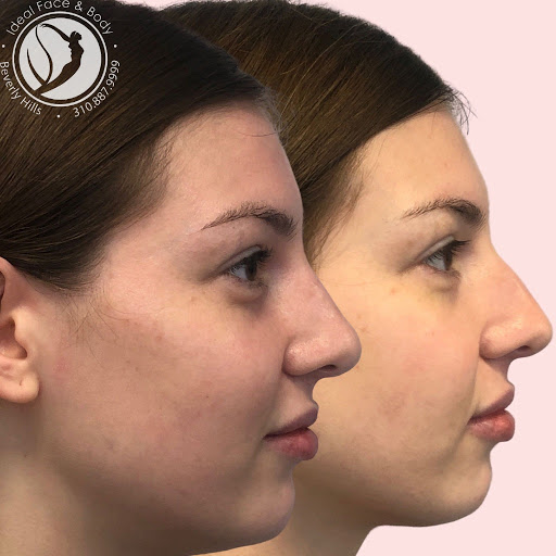 Ideal Face & Body image