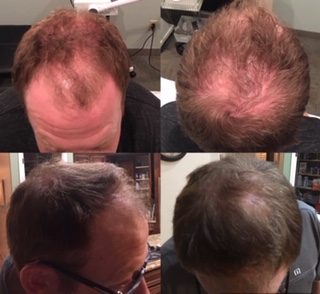 Laser Hair Removal Service «Pure Vanity Spa», reviews and photos, 20511 N Hayden Rd, Scottsdale, AZ 85255, USA