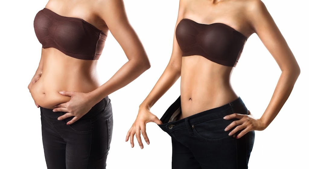 CoolSculpting Phoenix 85028