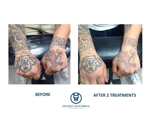 Explore trust tattoo ideas, creative tattoo ideas in San Diego, available at Removery Tattoo Removal & Fading