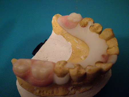 Panama Dental Lab - Panama Dental Lab