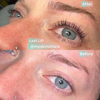 My Skin Oh Lala - Photo 9 - Car repair in The Woodlands, TX, The Woodlands