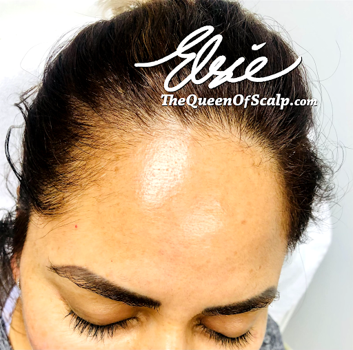 SMP Hair Clinic The Queen Of Scalp image