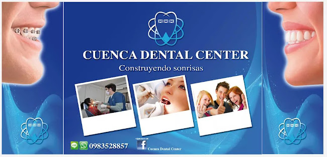 Opiniones de CUENCA DENTAL CENTER en Cuenca - Dentista