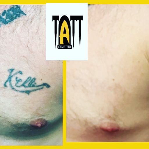 Explore cover up tattoo ideas for lower back, creative tattoo ideas in Fort Myers, available at Laser Tattoo Removal by Tatt Cemetery