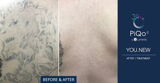 Explore ayahuasca tattoo ideas, creative tattoo ideas in Hallandale, available at Laser Treatments by Ageless Body Clinic