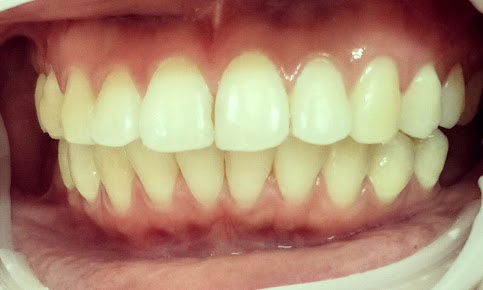 Winsome Smile Today - Winsome Smile Today