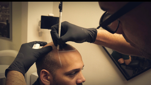 Clinics hair transplant clinics Orlando