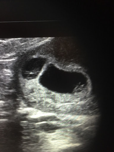 Medical Diagnostic Imaging Center «My little baby 4d & boutique», reviews and photos, 8930 TX-121, McKinney, TX 75070, USA