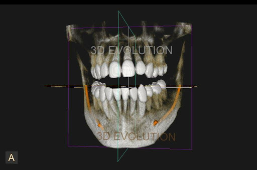 3D Evolution Dental Qro