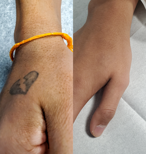 Explore minimalist lotr tattoo ideas, creative tattoo ideas in Rochester, available at Rochester Tattoo Removal