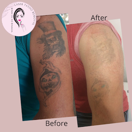 Explore midsommar tattoo ideas, creative tattoo ideas in Naples, available at Laser Tattoo Removal Services