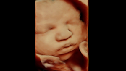 Image Of Love Ultrasound, LLC