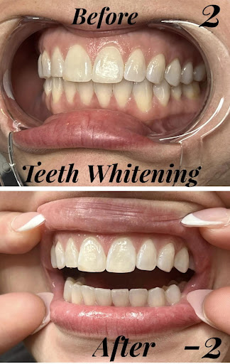 Explore tattoo ideas black and white, creative tattoo ideas in Roscoe, available at Skin Deep Studio Body Art & Beauty