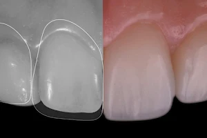 ORA - Clínica de Medicina Dentária - Médicos Dentistas - Especialistas em Estética e Reabilitação Oral Avançada image