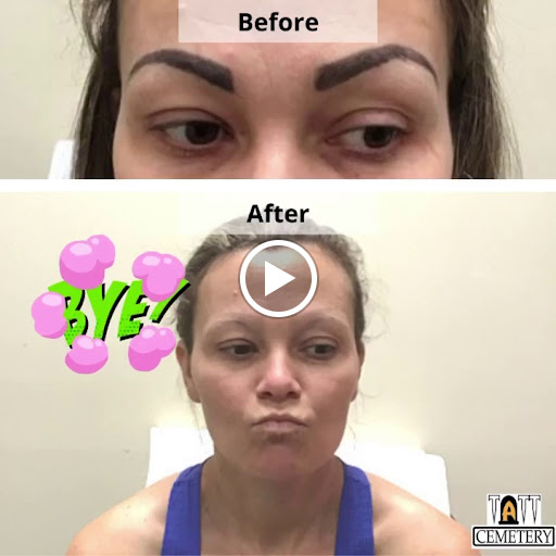 Explore wwe tattoo ideas, creative tattoo ideas in Fort Myers, available at Laser Tattoo Removal by Tatt Cemetery