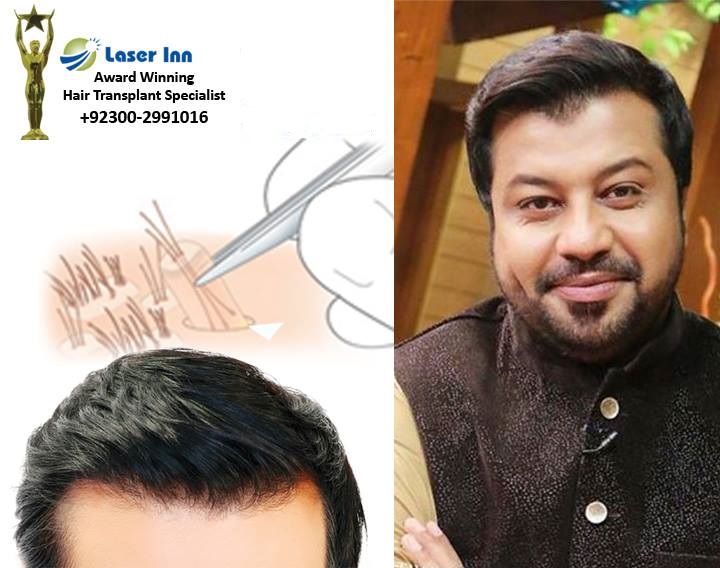 Laser Inn Aesthetic Hair Transplant Karachi