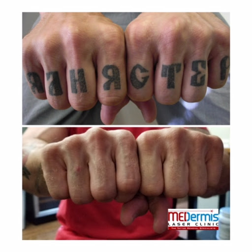 Explore praying hands tattoo ideas, creative tattoo ideas in San Antonio, available at MEDermis Tattoo Removal