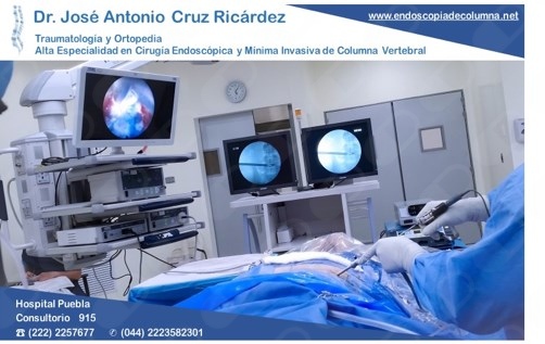 DR. José Antonio Cruz - Cirujano de columna vertebral y Endoscópica de Columna