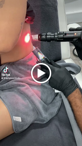 Explore 1993 tattoo ideas, creative tattoo ideas in New York, available at Ag2g Laser Tattoo Removal & MedSpa