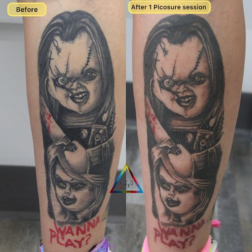 Explore easy tattoo ideas for beginners, creative tattoo ideas in New York, available at Ag2g Laser Tattoo Removal & MedSpa