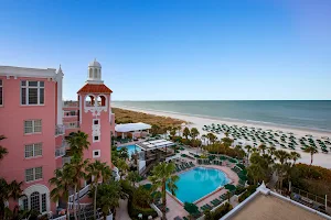 The Don CeSar image