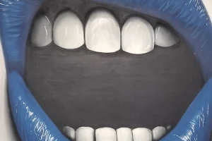 Clínica Dental Cantador Santa Perpetua image