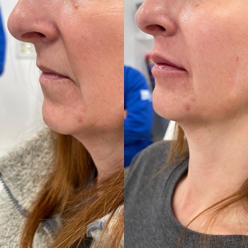 Explore cat tattoo idea, creative tattoo ideas in Owensboro, available at The Skin Lab