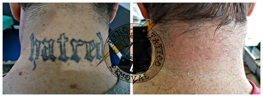 Explore nf tattoos ideas, creative tattoo ideas in Reno, available at Reno Tattoo Removal