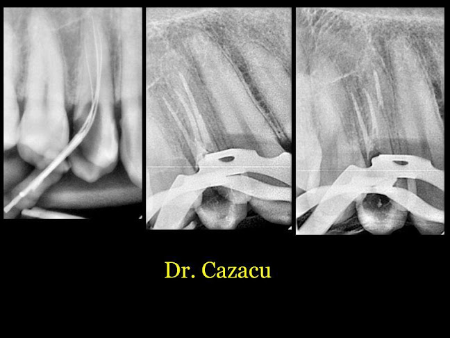 Dr. Cazacu Stomatologie CNC Dental ART - Dentist