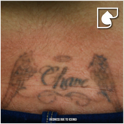 Explore it movie tattoo ideas, creative tattoo ideas in South Gate, available at Tattoo Removal Inc